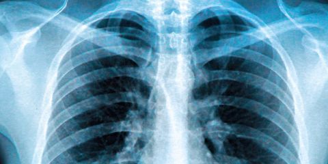 X-ray & Fluoroscopy