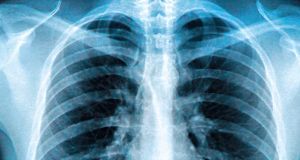 X-ray & Fluoroscopy