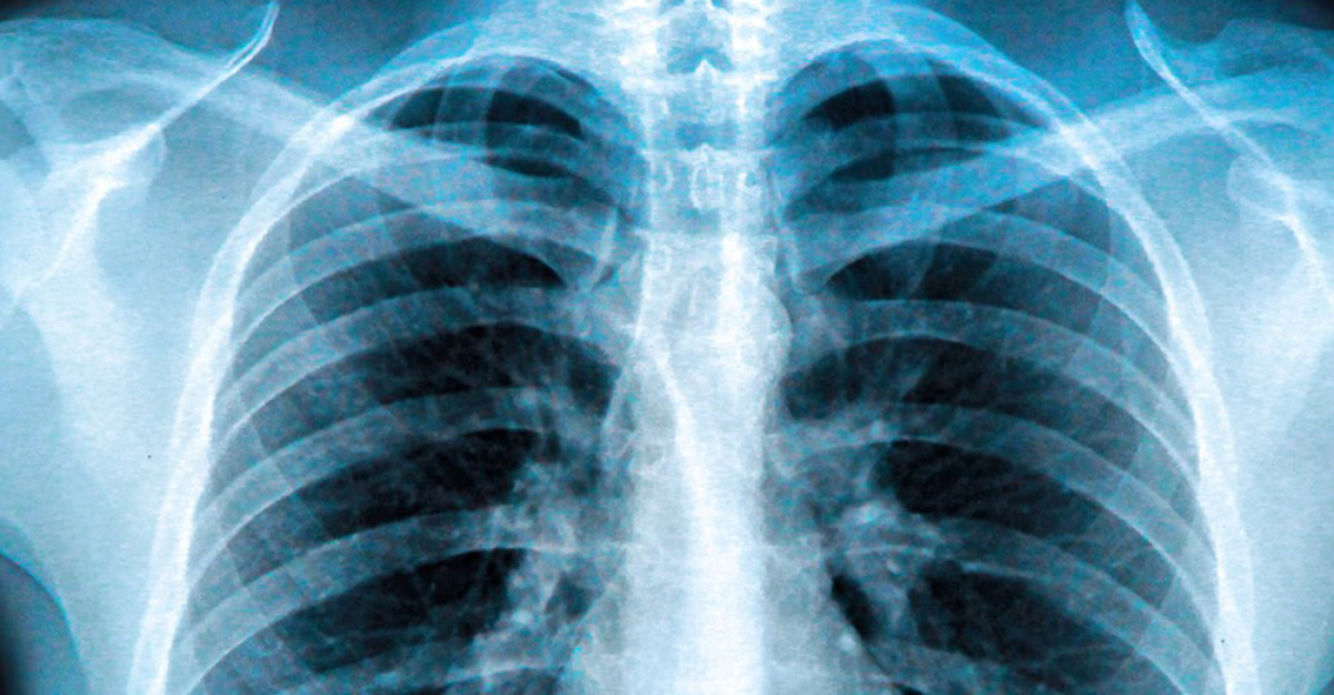 X-ray & Fluoroscopy